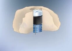 3 LED-LIGHTS Met Vervangbare LED Krans -Vijverbenodigdheden 3 led lights met vervangbare ledkopjes 0 400x283 1